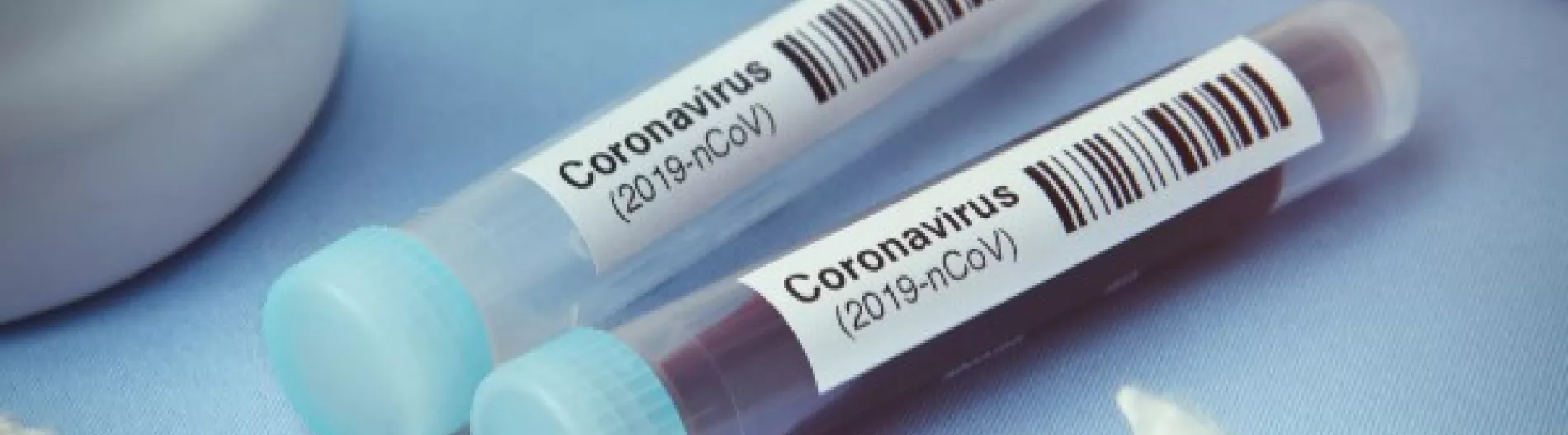 Coronavirus, Corona, COVID-19